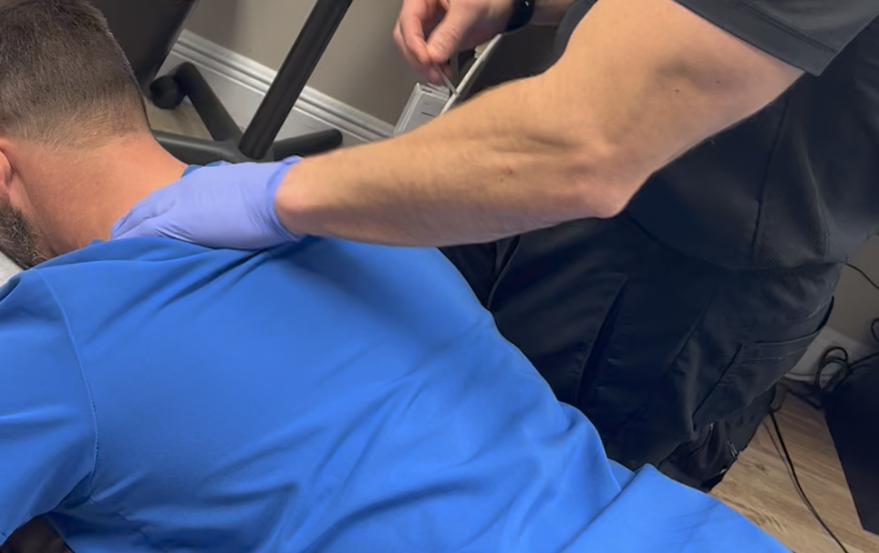 Dr Will gets Dry Needling for Trigger Point Therapy Wesley Chapel  FL 33543